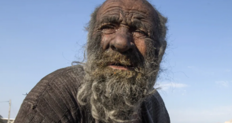Homem conhecido como 'o mais sujo do mundo' morre no Irã meses depois de tomar banho