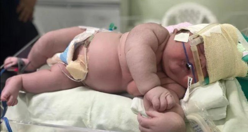Mãe dá à luz a “bebê gigante” de 7,3 kg e bate recorde